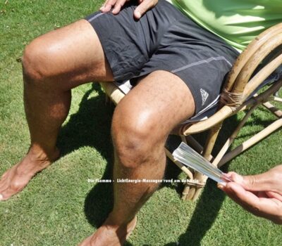 Flamme-Wb-Knie-I